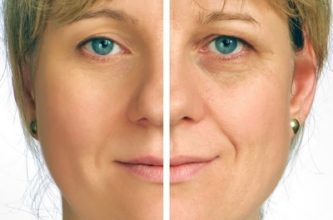 Dlaczego powstają zmarszczki?