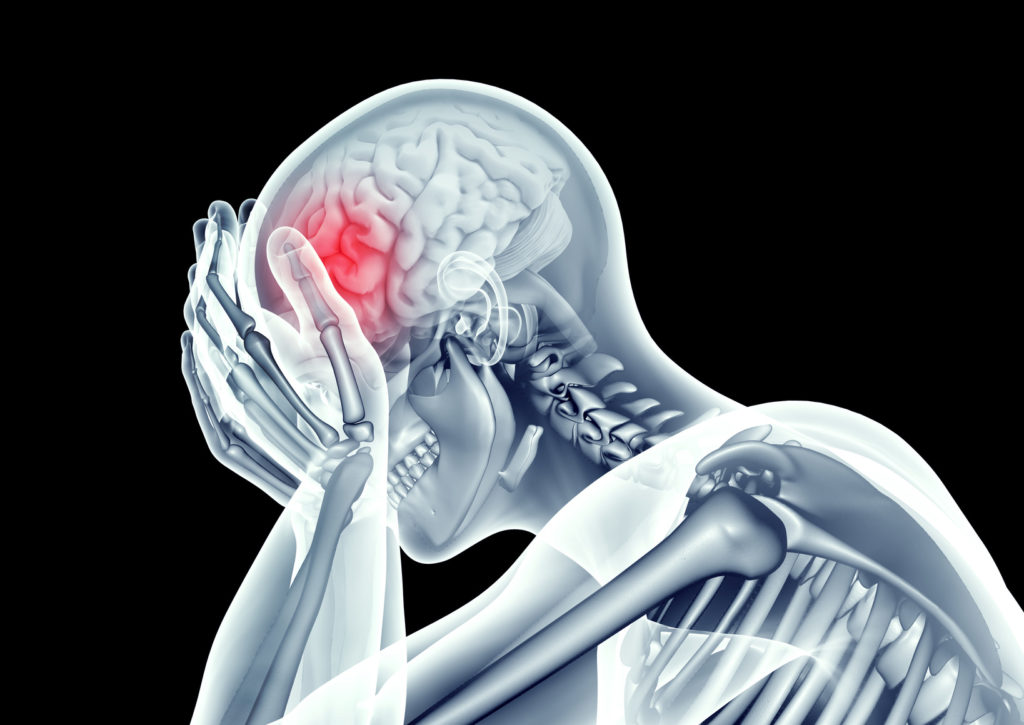 x-ray image human head with headache pain