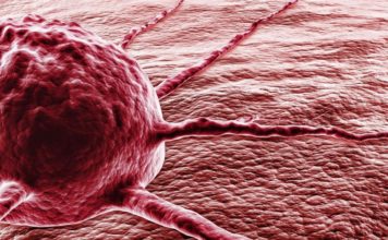 Leczenie nowotworu sodą oczyszczoną rak, nowotwór, soda